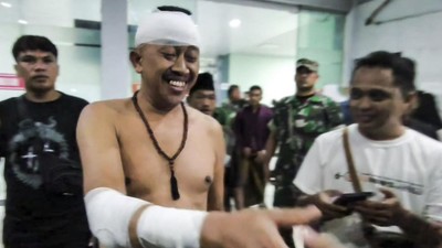 Kepala Desa Pakel Cabut Laporan, Polisi Tetap Lanjutkan Proses Hukum Kasus Penganiayaan